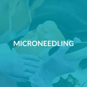 Microneedling service at Skin Blossom Pro